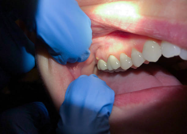 Best Cracked Tooth Emergency Dentist  in Hillsboro, KS
