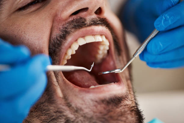 Best Knocked-Out Tooth Emergency  in Hillsboro, KS